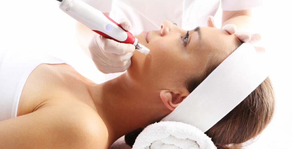 Needle,Mesotherapy.beautician,Performs,A,Needle,Mesotherapy,Treatment,On,A,Woman's